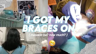 I GOT MY BRACES ON 🦷 vlog  braces experience [upl. by Sidra610]