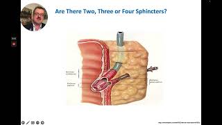 ERCP  Basic Principles of Biliary Sphincterotomy [upl. by Boland]