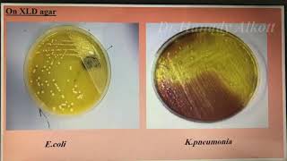 🤓🥳Enterobacteriaceae العملي 🤓😷 [upl. by Ecnedurp440]