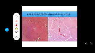 Histology Slides Series Episode 12  Accessory Organs of Digestion Liver Pancreas Gallbladder [upl. by Griffith]