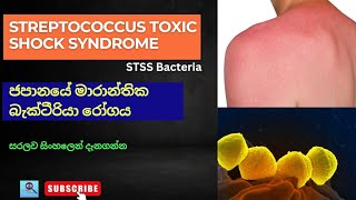 Streptococcus Toxic Shock Syndrome  STSS Bacteria  මාරාන්තික බැක්ටීරියා රෝගය stss streptococcus [upl. by Sansbury154]