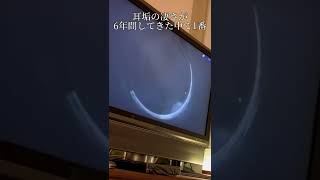 【耳掃除】プロが6年間の中で1番凄いと言った耳垢を除去！フル動画前編は概要欄から [upl. by Grane844]