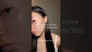 Microneedling at home for sensitive skin eczema rosacea koreanskincare kbeauty reedleshot [upl. by Lupien605]