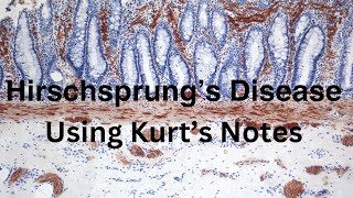 Hirschsprung’s Disease Using Kurt’s Notes pathagonia [upl. by Schwejda]