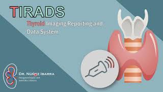 Sistema ACRTIRADS para nódulos tiroideos  DrPowerDoppler [upl. by Ymarej]