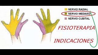 Lesion de nervio mediano en Fisioterapia Indicaciones [upl. by Eissel]