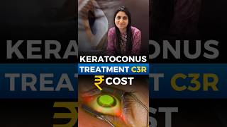 Keratoconus Treatment Cost C3R [upl. by Kahlil]