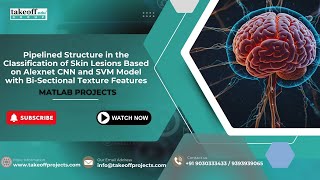 Pipelined Structure in the Classification of Skin Lesions Based on Alexnet CNN and SVM Model with Bi [upl. by Ilera706]