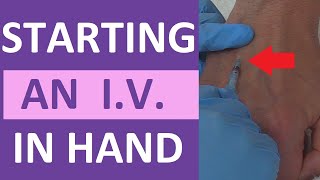 How to Start an IV  IV Catheter Insertion amp Flush Technique in Hand  Nursing Skill [upl. by Eile]