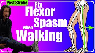 Fix a spastic Leg Post Stroke [upl. by Hnahym]