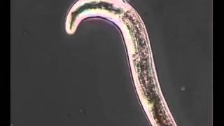 Nematodo Meloidogyne [upl. by Khalil]