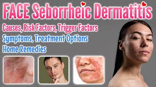 Seborrheic Dermatitis Face Causes Risk amp Trigger Factors Symptoms Treatment Options Home Remedies [upl. by Eiliab384]