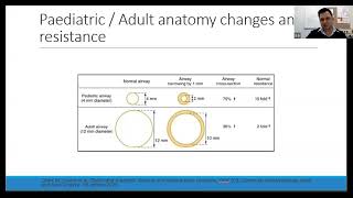 Acquired Paediatric Subglottic Stenosis  Dr Suraj Gaire [upl. by Jobey]