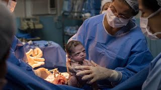 Caesarean section for pregnant give birth to 4 children [upl. by Gracie]