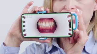 Invisalign Virtual Care [upl. by Idnyc470]