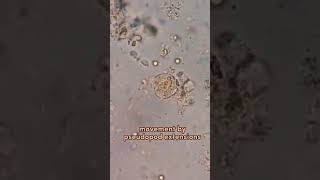 entamoeba histolytica locomotion pseudopodia amazing [upl. by Nytsud]