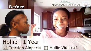 Hair Loss Treatment for Women Result  Traction Alopecia Hair Loss Treatment Result Hollie [upl. by Enilada]