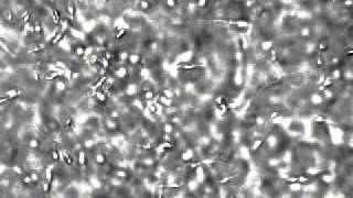 Semen sperm cells under the microscope at 400x [upl. by Jeana]