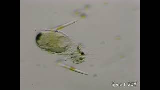 Heliozoa consuming a ciliate [upl. by Sacci]