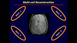 M219 2016 Lecture 17  Fast Imaging with Clinical Application Peng Hu PhD [upl. by Sancha]