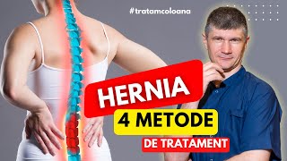 Hernia de disc 4 metode de tratament Pe care ați încercato [upl. by Enilarak]