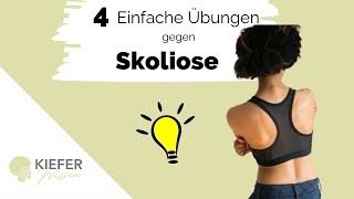 Skoliose Übungen der besonderen Art [upl. by Aleacin]