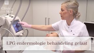 LPG endermologie behandeling gelaat [upl. by Orips]