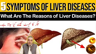 Symptoms of Liver Diseases  What Are The Reasons of Liver Diseases  How Is Liver Test Performed [upl. by Iramohs827]