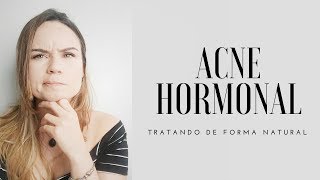 ACNE HORMONAL  COMO TRATAR DE FORMA NATURAL [upl. by Joyce73]