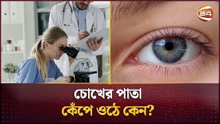 চোখের পাতা কেঁপে ওঠে কেন  Eye twitching Causes  Channel 24 [upl. by Bernadina]