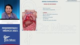 Cirugía pediátrica  5 Malformaciones del diafragma [upl. by Eenor]