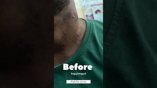 Skin allergy treatment skin  derma skincare  by Dr Danish pasha [upl. by Emmaline204]