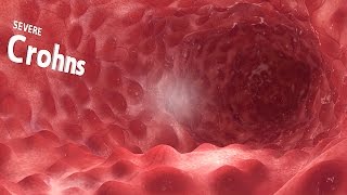 360° VR animation  inside the GI tract [upl. by Acinorrev]