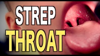 Strep Throat LIVE DIAGNOSIS [upl. by Norek]