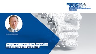 AO Spotlight Periimplantitis Its evolution factors and treatment [upl. by Chura]