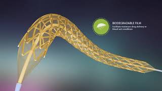 Abluminus DES Designed to Treat Diabetic Patients Sirolimus Eluting Coronary Stent [upl. by Halimaj]