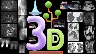 TOP THREE DIFFERENTIAL DIAGNOSIS SET II [upl. by Irrac518]