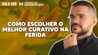 COMO ESCOLHER O MELHOR CURATIVO NO TRATAMENTO DE FERIDAS LIVE86 [upl. by Nnylyt621]