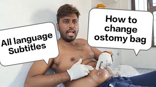 How to change ostomy bag nursing  Changing an ostomy bag  How to change Colostomy bag [upl. by Hillard]