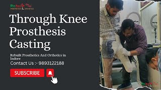 Casting of Knee Prosthesis in Rebuilt Indore  Casting  Knee Prosthesis viral video sub [upl. by Nylcaj]