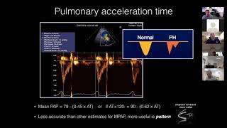 Pulmonary Haemodynamics [upl. by Audre17]