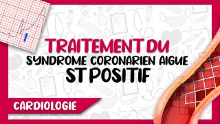 Prise en Charge amp Traitement du Syndrome Coronarien Aigu avec Segment ST Positif [upl. by Shermie]