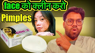 CLIN  3 Soap For Acne Pimple Face  No More Acne On Face  pharmachoice [upl. by Nitsirhc601]