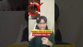 Botak Gegara Warnain Rambut Aduhai Geramnyeee [upl. by Ymmas]