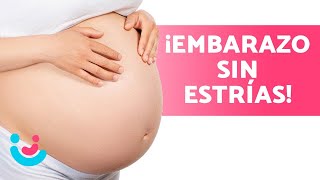 ¿Cómo EVITAR las ESTRÍAS en el EMBARAZO 🤰🏻 12 Consejos [upl. by Annahvas993]