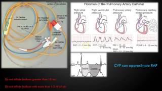 Hemodynamic Monitoring Part 1 [upl. by Pence416]