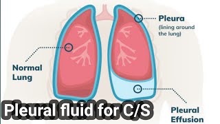 Pleural fluid Culture and Sensitivity CS test full explained [upl. by Clapp]