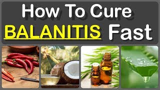 How To Cure Balanitis With Oils Fast And Causes Symptoms And Treatment Of Balanitis [upl. by Robena509]