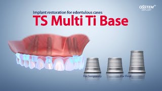 Implant restoration for edentulous cases quotTS Multi Ti Basequot [upl. by Eisteb641]