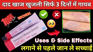 derobin cream kis kaam mein aata hai  derobin cream uses in hindi  derobin  dad khaj khujali [upl. by Niveek]